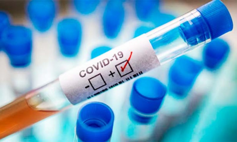 COVID-19: Sobe para 120 o número de casos confirmados em Vila Maria