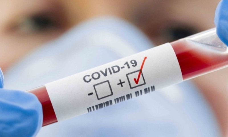 COVID-19: Depois de 7 semanas com casos ativos número de positivados começa a subir em Vila Maria