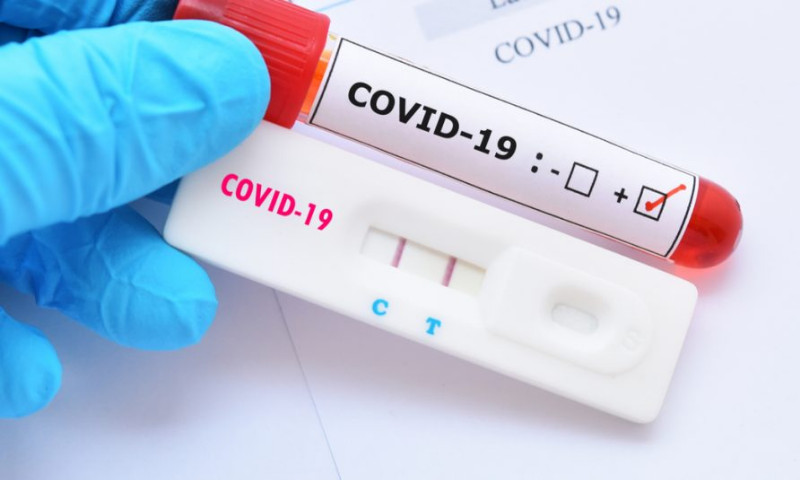 COVID-19: Casos positivos em Vila Maria continuam aumentando