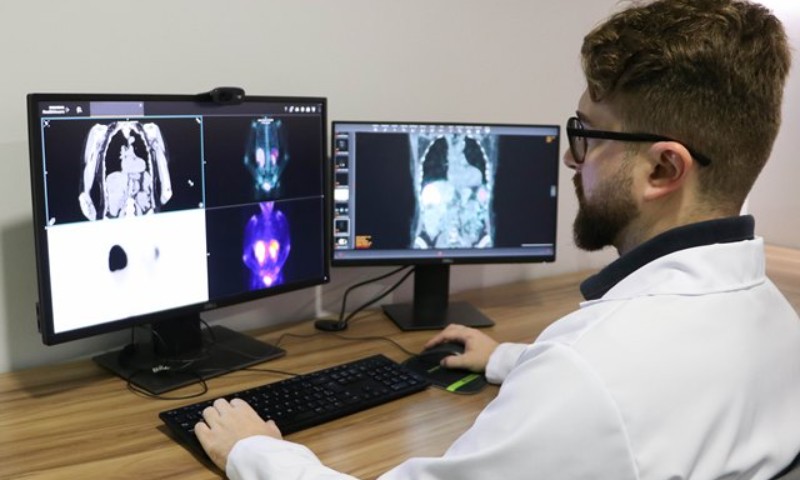 HSVP realiza procedimento inédito no Rio Grande do Sul para tratamento de tumor neuroendócrino com lutécio-177