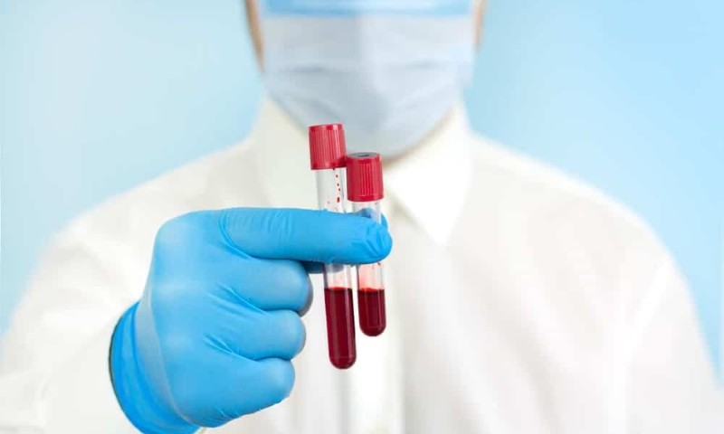SAÚDE: Exame de sangue que rastreia Alzheimer pode virar real