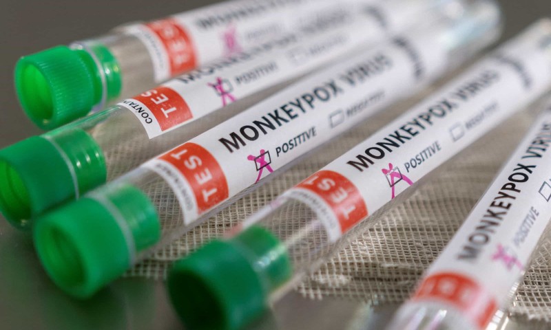 SAÚDE: É questão de tempo, diz médico sobre disseminação de Mpox pelo mundo