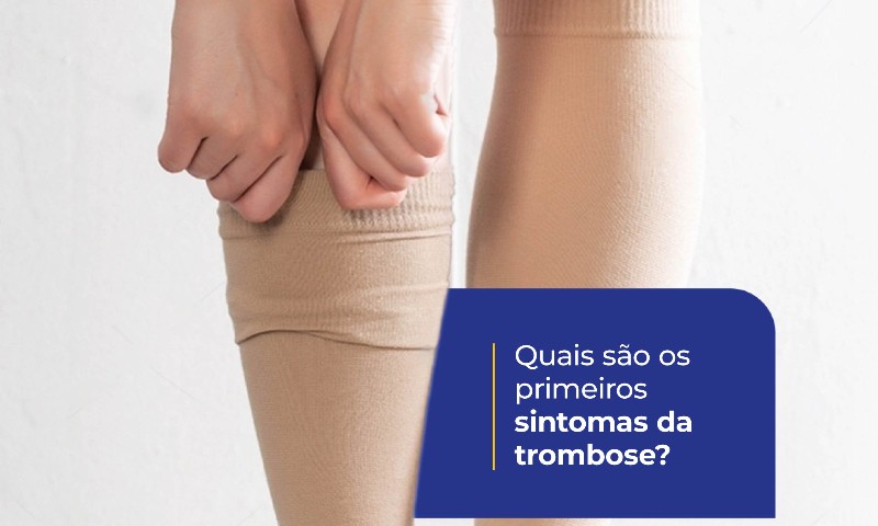 Entenda o que é a trombose venosa