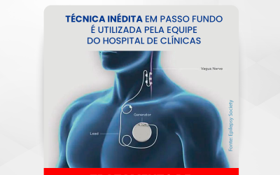 Técnica inédita, em Passo Fundo, para tratamento de epilepsia refratária