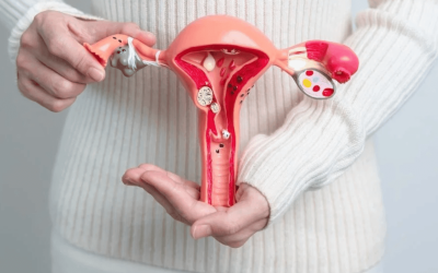 Endometriose: por que diagnóstico ainda demora até 10 anos?